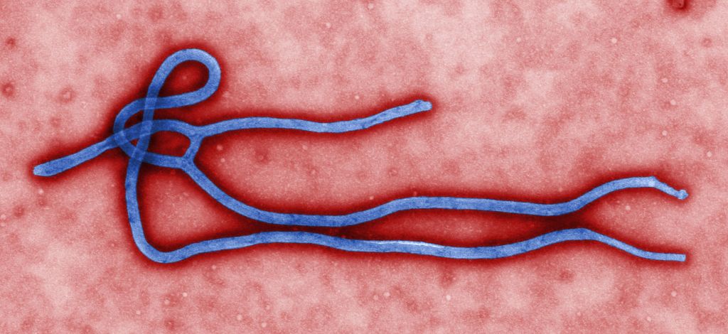 TEOTWAWKI Ebola Virus